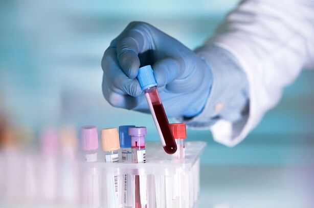 Ameliyat öncesi test